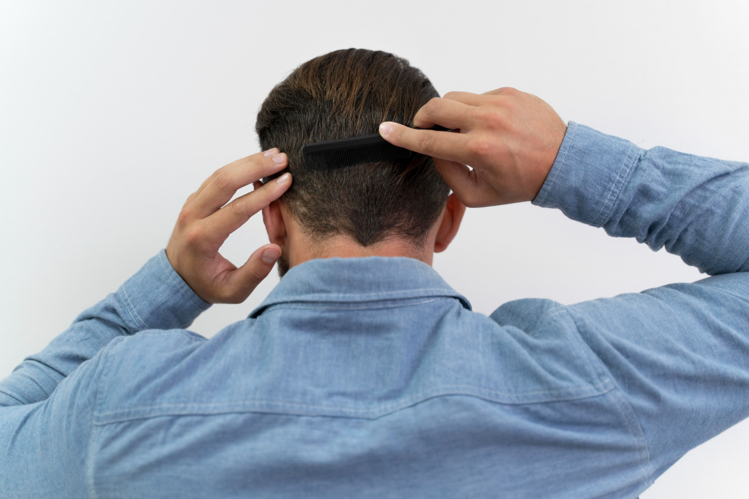 Tight Manbuns and Ponytails Can Cause Traction Alopecia and Thinning for on-Trend Guys