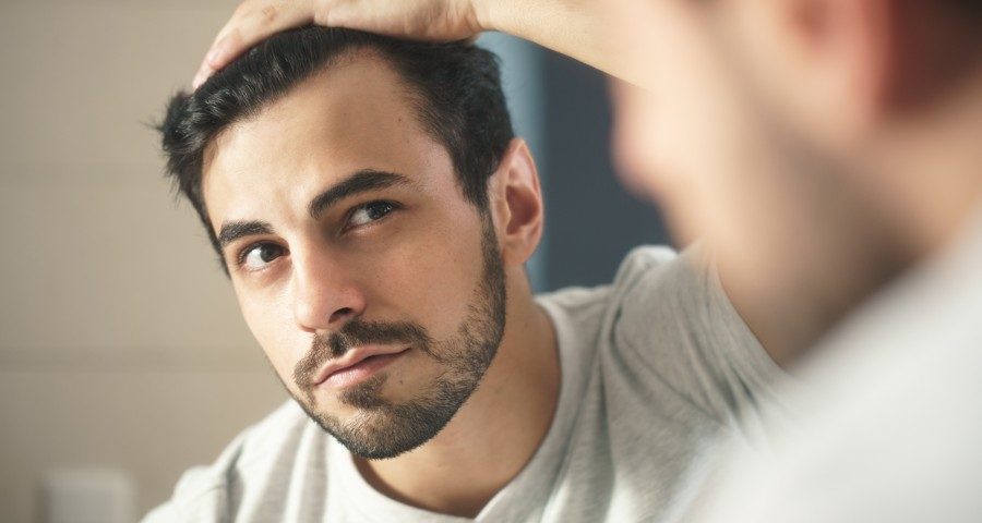 man worried for alopecia checking hair for loss 324FTZN