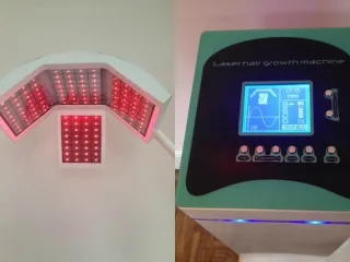 Benefits of Laser Hair Re-Growth Therapy